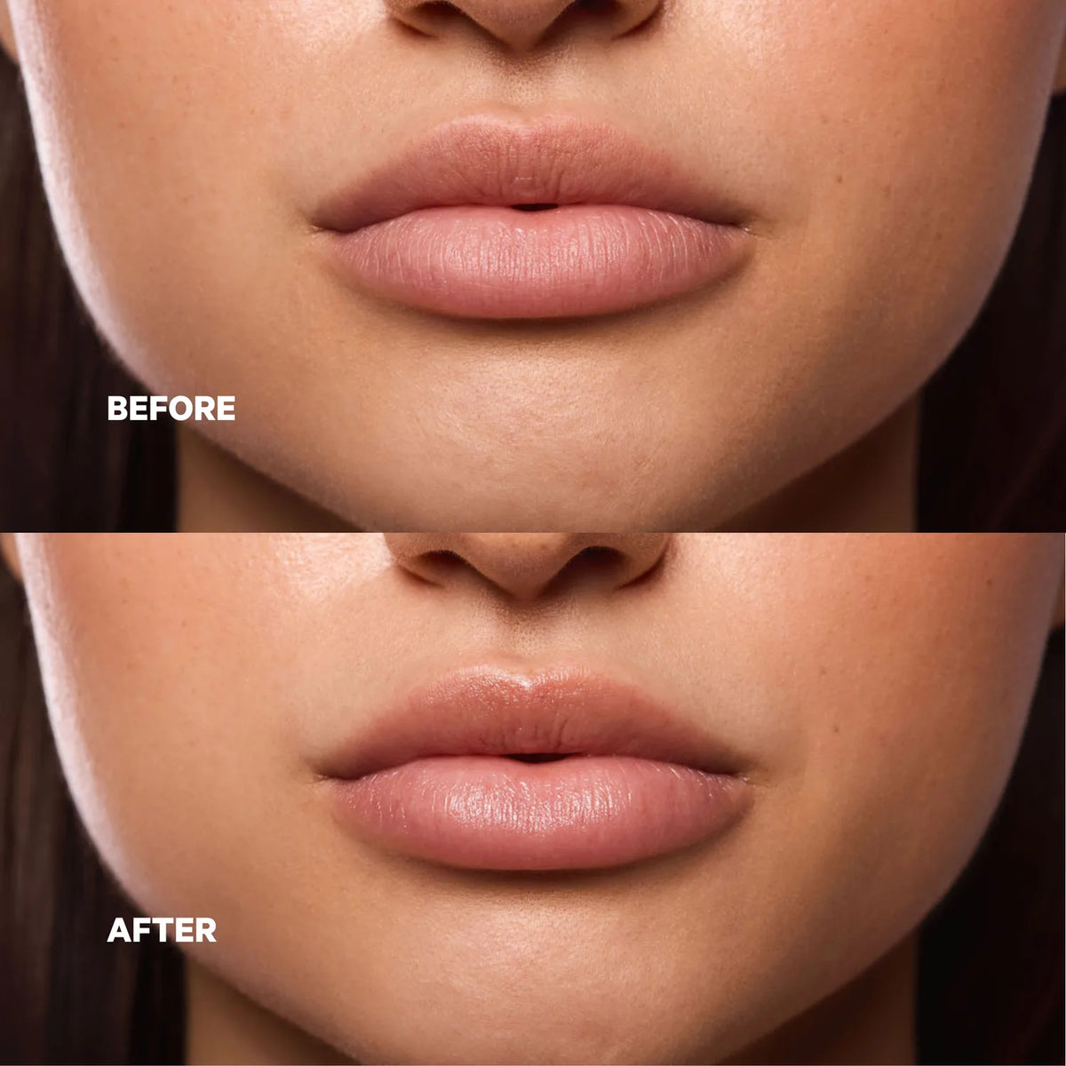 Before and after close-up of lips showing dry texture on top and smooth, softened lips on bottom after a lip treatment for dry lips.
